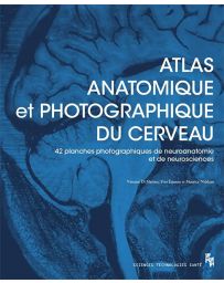 Atlas Anatomique et Photographique du Cerveau - 42 Planches dont 41 photographiques de Neuroanatomie et de Neurosciences